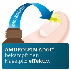 Amorolfin ADGC 50 mg / ml wirkstoffhalt.Nagellack, 3 ml