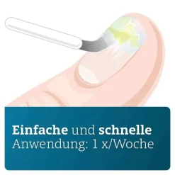 Amorolfin ADGC 50 mg / ml wirkstoffhalt.Nagellack, 5 ml