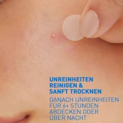 CeraVe Anti-Unreinheiten Patches, 22 St
