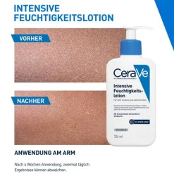 CeraVe Intensive Feuchtigkeitslotion, 236 ml><noscript><img width=