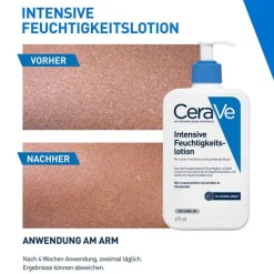 CeraVe Intensive Feuchtigkeitslotion, 473 ml><noscript><img width=
