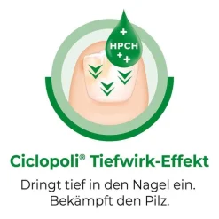 Ciclopoli gegen Nagelpilz, 6.6 ml