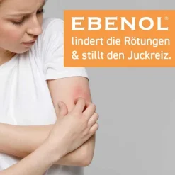 Ebenol 0,25% Creme, 50 g> Mittel Gegen Sonnenbrand|Mittel Bei Mückenstichen