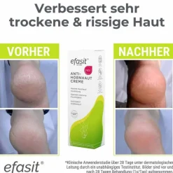 Efasit Anti-Hornhaut Creme, 75 ml><noscript><img width=
