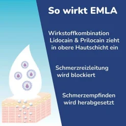 Emla Pflaster, 2X1 St