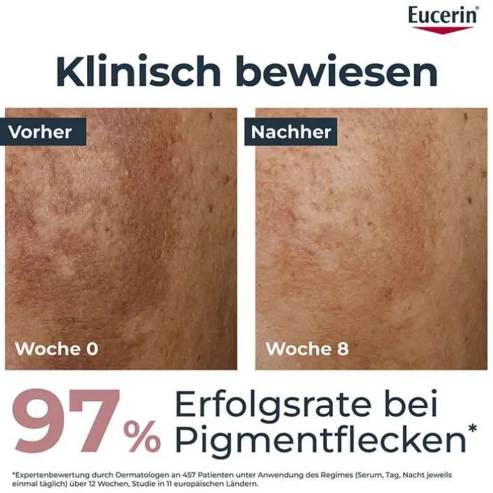Eucerin Anti-Pigment Tagescreme LSF 30, 50 ml> Tagespflege|Pigmentflecken