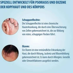 Evolsin® Ekzem & Psoriasis Shampoo, 250 ml