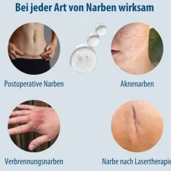 Evolsin Narben Gel, 20 g><noscript><img width=