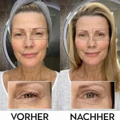 Lidperfect Augengel bei Schlupflidern, 15 ml><noscript><img width=