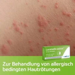 axicur Loratadin ® 10 mg Tabletten, 50 St><noscript><img width=