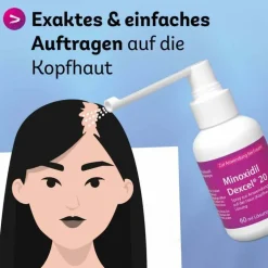 Dexcel Minoxidil 20 mg / ml Spray z.Anw.a.d.Kopfhaut, 60 ml><noscript><img width=