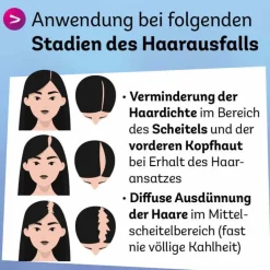 Minoxidil Dexcel 20 mg / ml Spray z.Anw.a.d.Kopfhaut, 3X60 ml