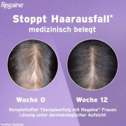 Regaine Frauen Lösung, 60 ml