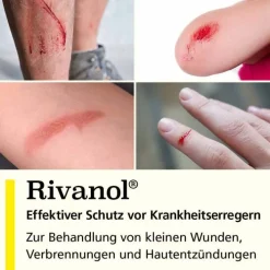 Rivanol 1,0 g Pulver, 50 St><noscript><img width=