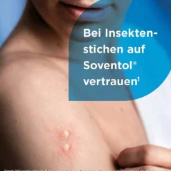 Soventol Gel bei Insektenstichen und Juckreiz auf der Haut, 50 g><noscript><img width=