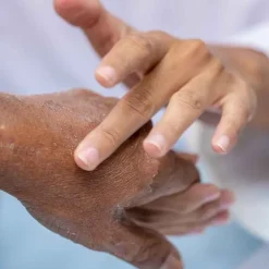 Phametra Urea / Harnstoffsalbe 10% ig, 100 g><noscript><img width=