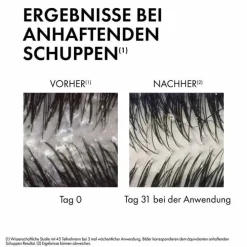 Vichy Dercos Anti-Schuppen Shampoo trockene Kopfhaut, 390 ml><noscript><img width=