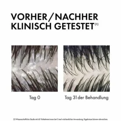 Vichy Dercos Anti-Schuppen 2in1 Shampoo und Conditioner, 200 ml