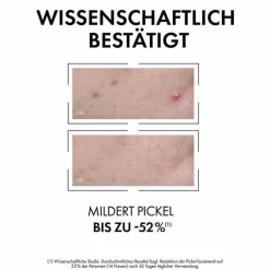 Vichy Normaderm Anti-Unreinheiten Serum, 30 ml