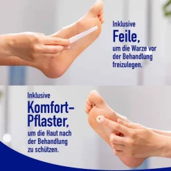 Wartner Fußwarzen Spray, 50 ml