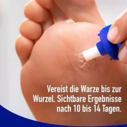 Wartner Fußwarzen Spray, 50 ml