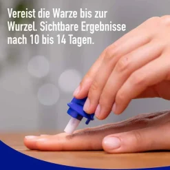 Wartner Warzen Spray, 50 ml